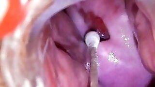 Spikylooking housewife getting a gyno
