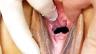 Blondes mamma gyno in addition to a little extra